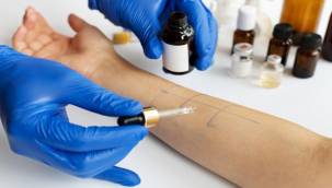 "ACI BAKLA, GİZLİ BİR ALERJENE DÖNÜŞTÜ"