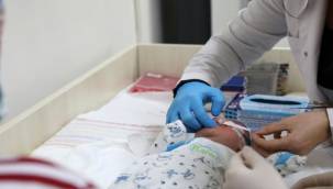 Deü Hastanesi Dudak-Damak Yarığı Tedavisinde Umut Oldu